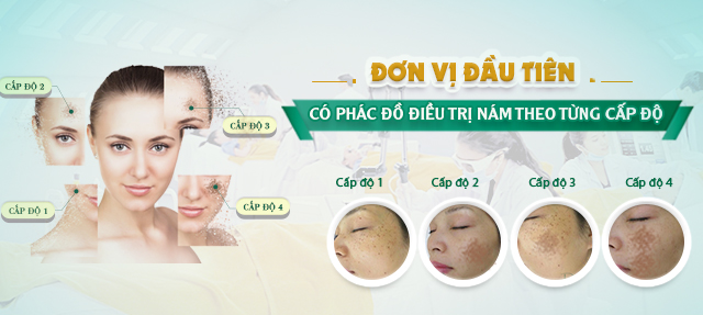 “Chấm điểm” các phương pháp trị nám hiệu quả nhất hiện nay
