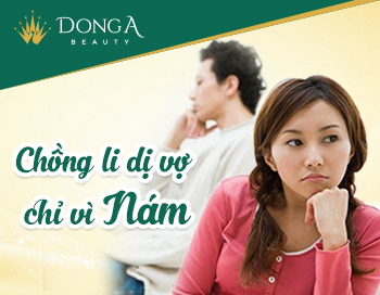 Ly dị vì không chịu nổi gương mặt đầy nám của vợ và cái kết bất ngờ