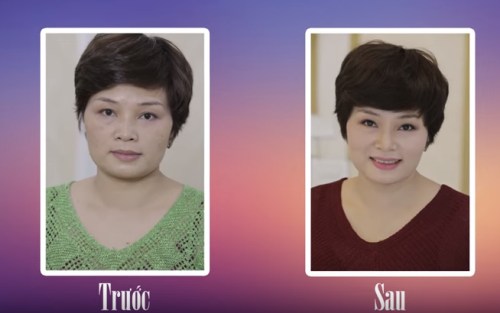 khách hàng trị nám sau 21 ngày