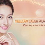 Trị nám cấp độ 2: Yellow Laser Advanced