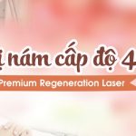Đặc trị nám cấp độ 4 bằng Premium  Regeneration Laser
