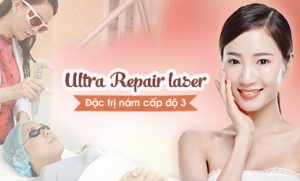 Trị nám cấp độ 3: Ultra Repair Laser đặc trị nám, ngừa tái phát