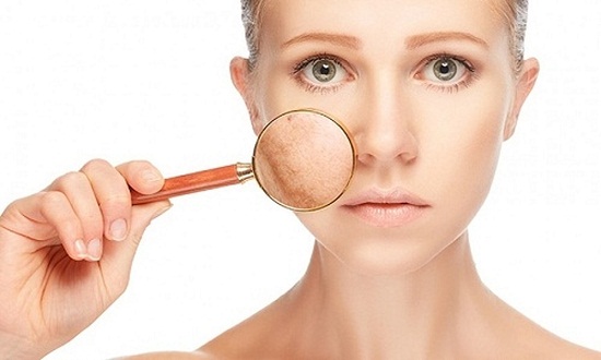 Top 7 cách trị nám da mặt bằng thiên nhiên an toàn tại nhà 10