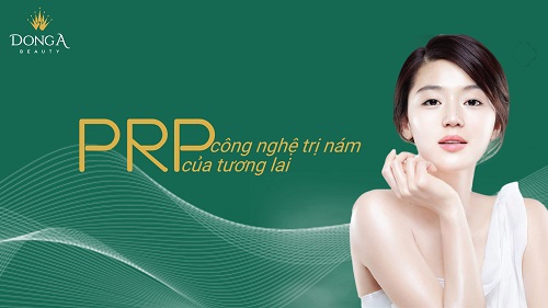 Trị nám bằng PRP – đón đầu công nghệ tương lai