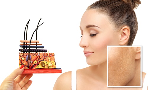 Nám – Tàn nhang, hai bệnh lý khác nhau nhưng ít người biết cách phân biệt